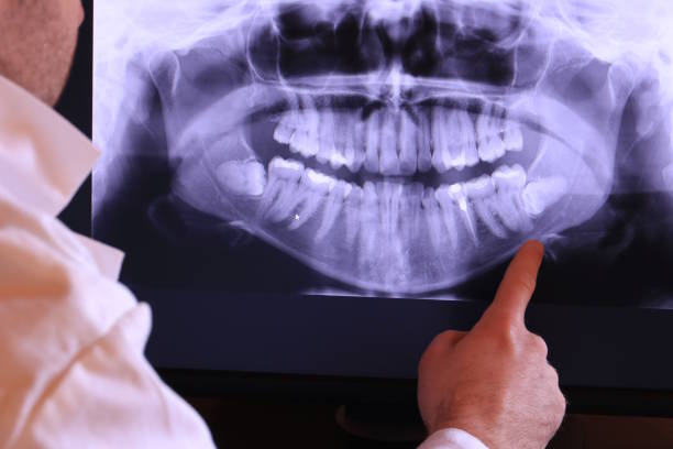 Best Emergency Dental Care for Broken or Chipped Teeth in Fort Benton, MT